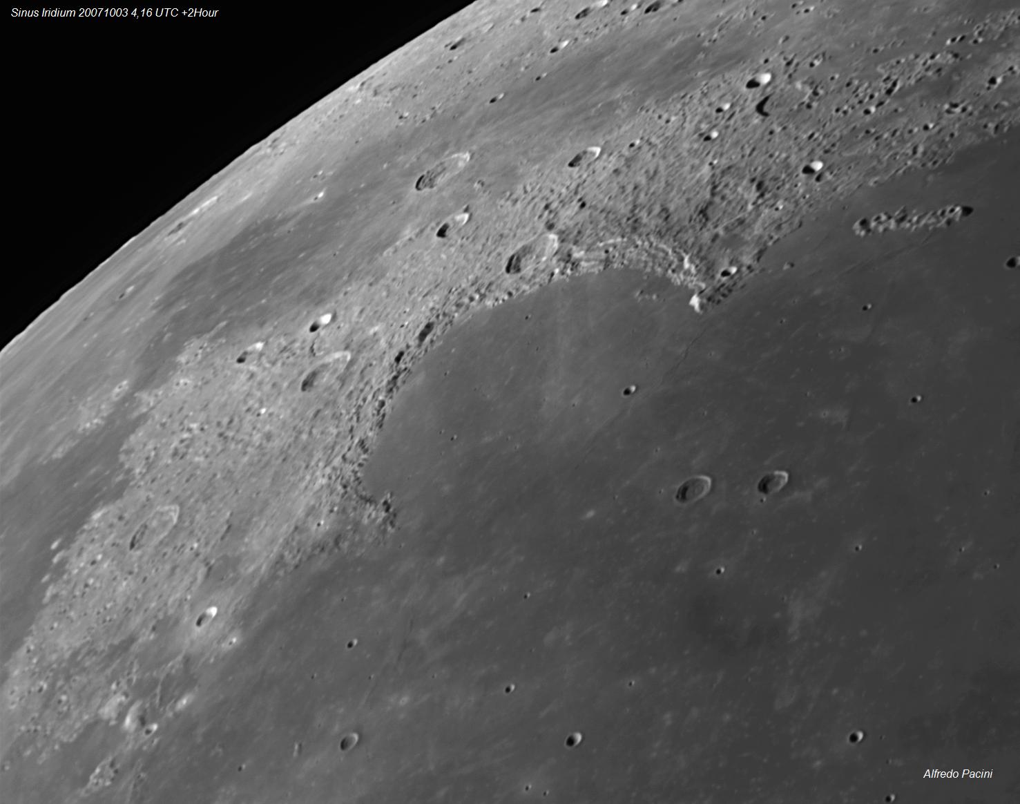 SINUS IRIDUM
